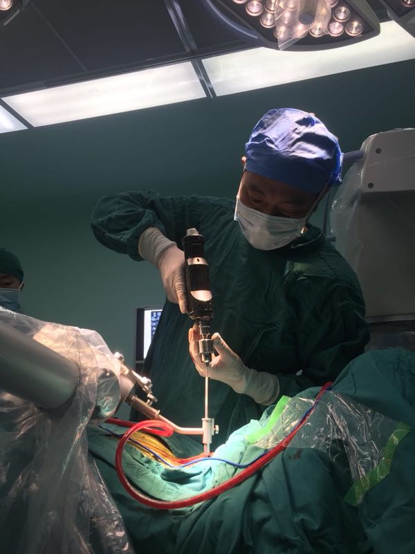 四川省医院医生联合手术机器人 完成世界首例