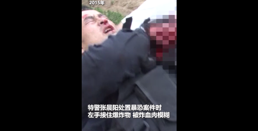 我还要拿枪……""不要给我截肢张晨阳不断恳请医生当医生说可能要