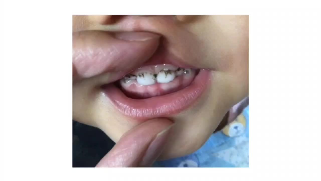 一周医讲请收好这份小朋友口腔保护指南