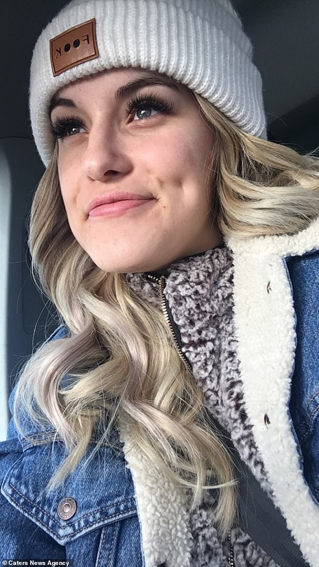 冷真会要命!21岁女子对冷过敏 开冰箱都是玩命