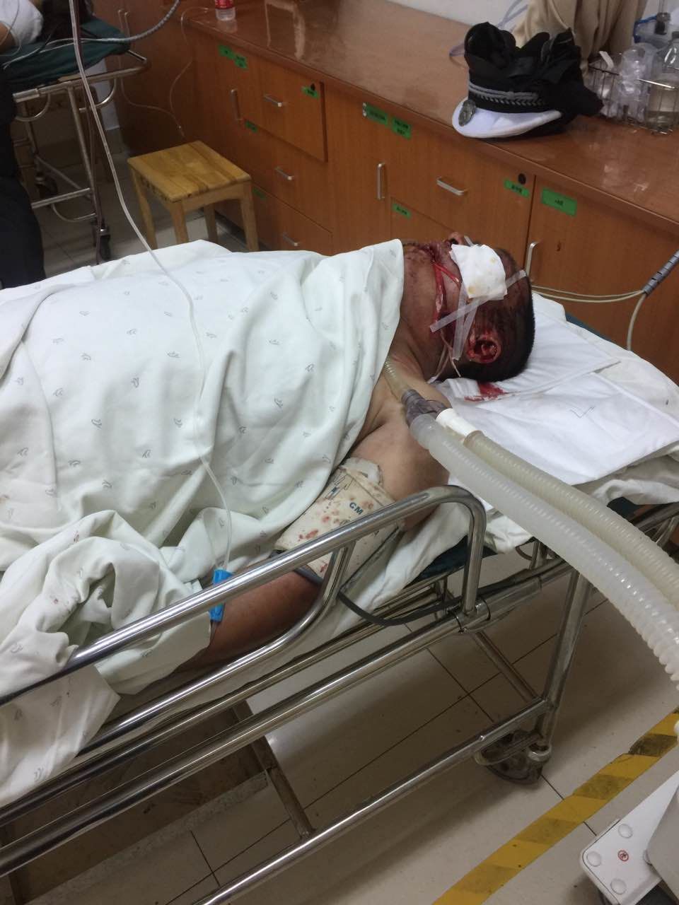 浙江绍兴酒驾摩托冲卡 致一协警重伤死亡