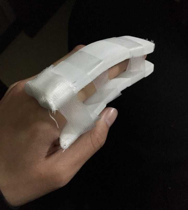 90后禁毒民警抓捕贩毒分子 手指骨折后忍疼再抓两人