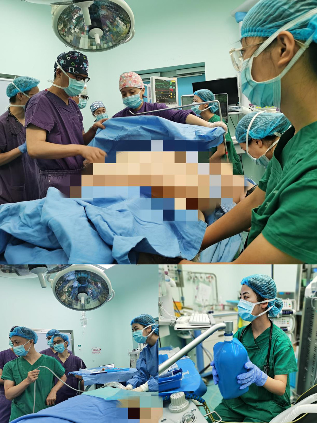 体重526斤腰围199厘米成都医院为超级肥胖患者完成减重手术