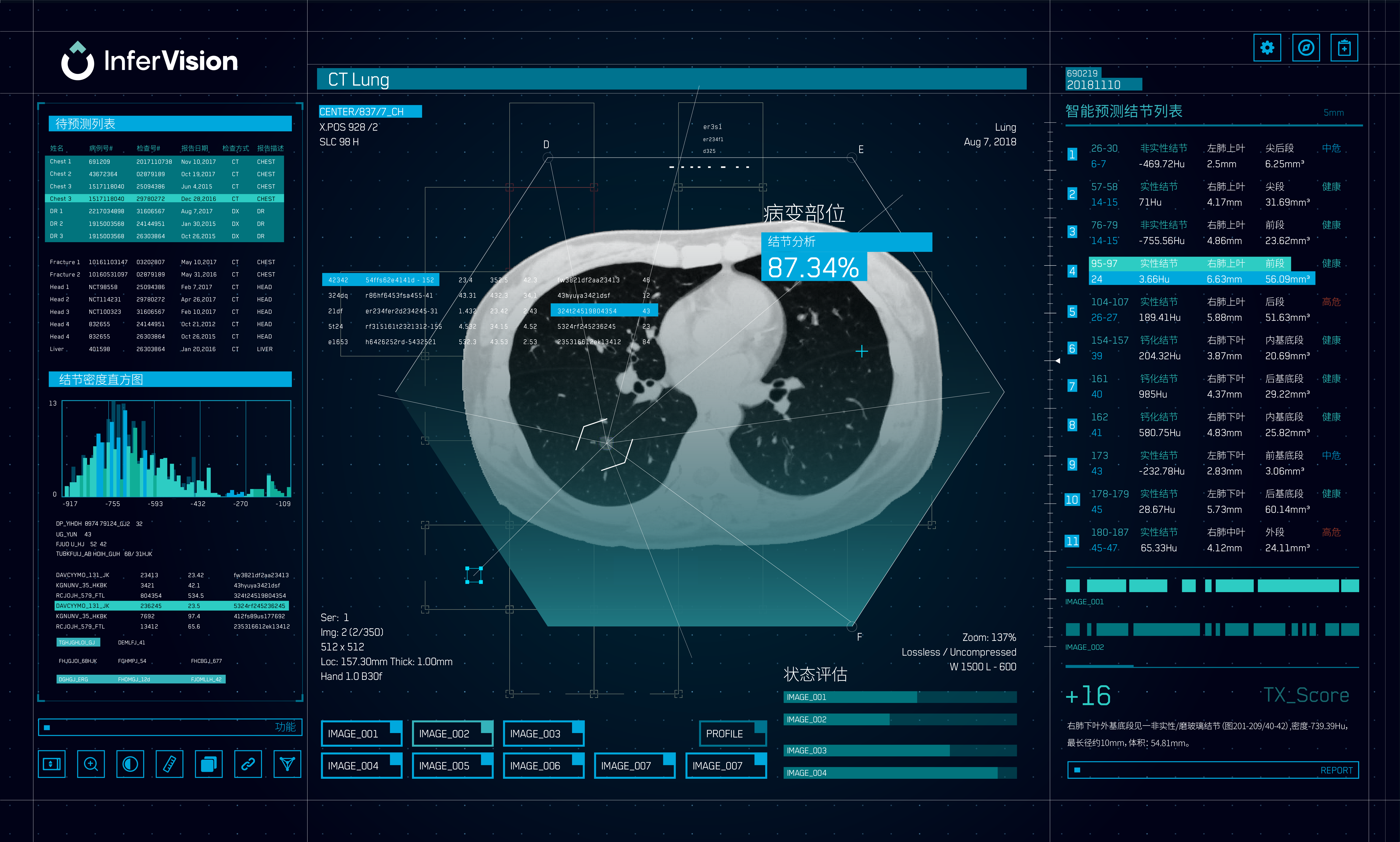 (受访者提供)新冠肺炎疫情期间,推想科技在国内推出了针对新冠肺炎的