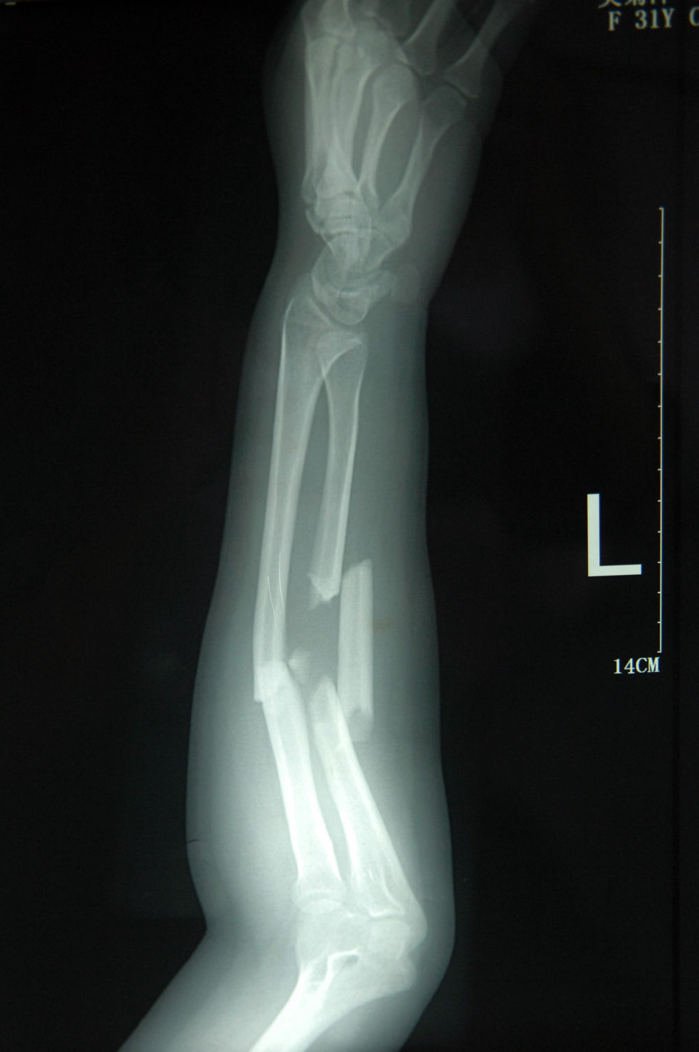 我在现场照片背后的故事纪念一次奇迹发生的十年之后