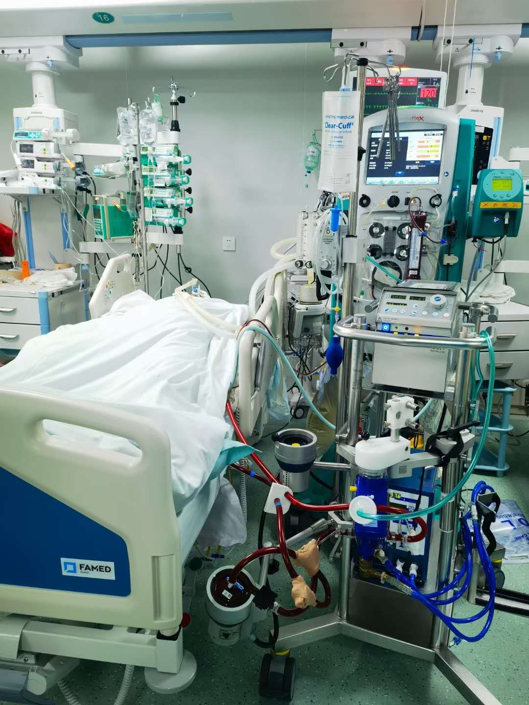 图为"人工肺"机器.