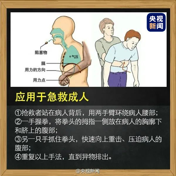 孩子被异物卡喉窒息怎么办学会这一招关键时刻能救命
